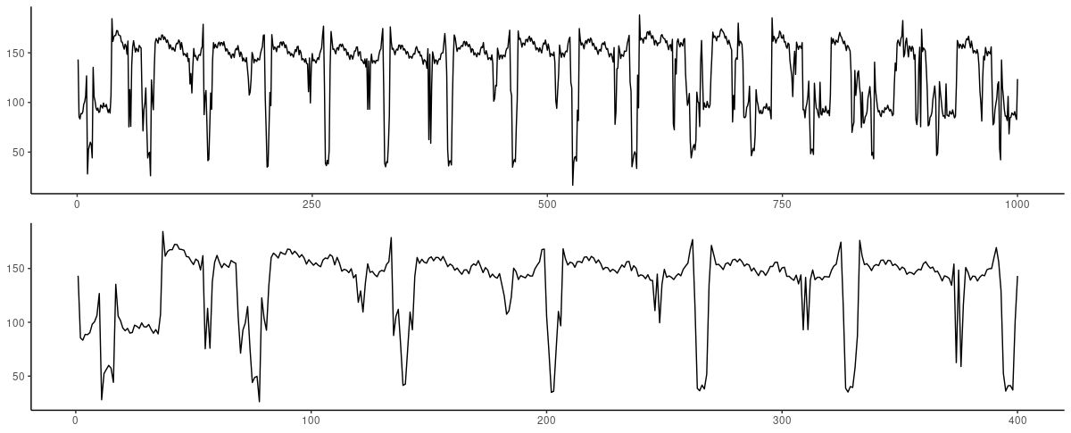 ECG dataset. Top: First 1000 observations. Bottom: Zooming in on the first 400 observations.