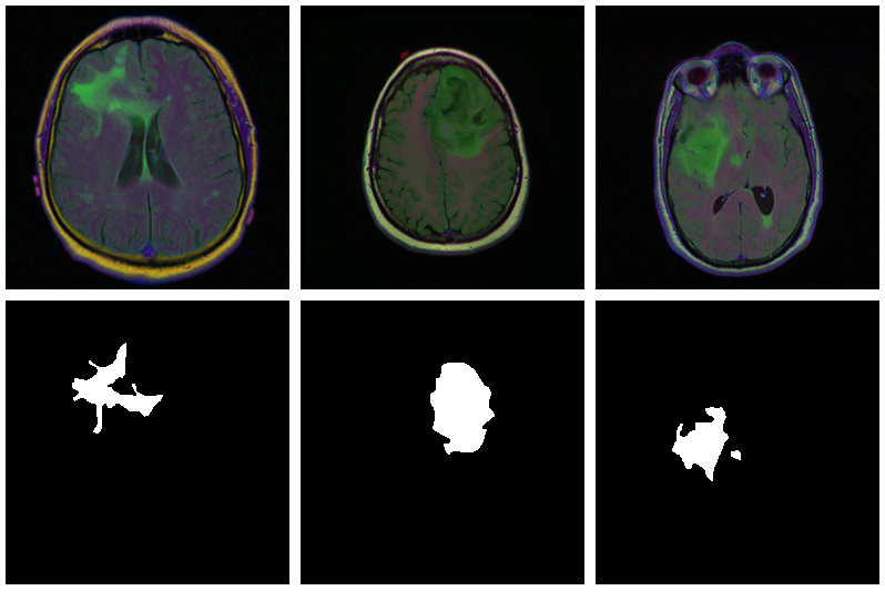 Brain segmentation deep store learning